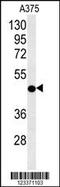 Citrate Synthase antibody, MBS9202690, MyBioSource, Western Blot image 