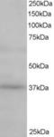 ATPase H+ Transporting Accessory Protein 2 antibody, EB06118, Everest Biotech, Western Blot image 