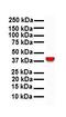 Acid Phosphatase, Prostate antibody, orb330209, Biorbyt, Western Blot image 