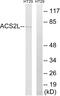 Acyl-CoA Synthetase Short Chain Family Member 1 antibody, GTX87873, GeneTex, Western Blot image 