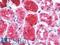 Glutathione S-transferase P 1 antibody, LS-B9638, Lifespan Biosciences, Immunohistochemistry paraffin image 