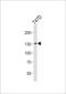 ATPase Family AAA Domain Containing 2 antibody, LS-C156559, Lifespan Biosciences, Western Blot image 