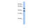 Phosphatase And Actin Regulator 3 antibody, 26-795, ProSci, Western Blot image 