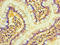 Transmembrane Protein 44 antibody, LS-C370448, Lifespan Biosciences, Immunohistochemistry paraffin image 