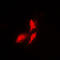 Ribosomal Protein S6 Kinase B1 antibody, LS-C352826, Lifespan Biosciences, Immunofluorescence image 