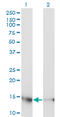 Ubiquitin Conjugating Enzyme E2 D3 antibody, LS-C198394, Lifespan Biosciences, Western Blot image 