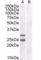 Suppressor Of Cytokine Signaling 1 antibody, orb18302, Biorbyt, Western Blot image 