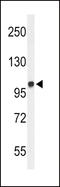 Microtubule Associated Monooxygenase, Calponin And LIM Domain Containing 2 antibody, LS-C164187, Lifespan Biosciences, Western Blot image 