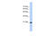 Transcription Elongation Factor A Like 8 antibody, 26-513, ProSci, Western Blot image 