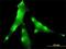 Ena/VASP-like protein antibody, H00051466-M01, Novus Biologicals, Immunocytochemistry image 