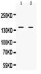 Nuclear receptor-interacting protein 1 antibody, RP1095, Boster Biological Technology, Western Blot image 