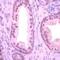 Streptococcus agalactiae antibody, MA1-91193, Invitrogen Antibodies, Immunohistochemistry paraffin image 