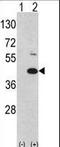 MOS Proto-Oncogene, Serine/Threonine Kinase antibody, LS-C101160, Lifespan Biosciences, Western Blot image 