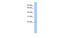 Tumor Suppressor Candidate 1 antibody, MBS5300530, MyBioSource, Western Blot image 