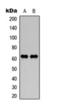 Neurofilament Light antibody, orb393119, Biorbyt, Western Blot image 