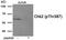 Checkpoint Kinase 2 antibody, 79-985, ProSci, Western Blot image 