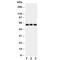 Hexosaminidase Subunit Alpha antibody, R30882, NSJ Bioreagents, Western Blot image 