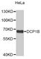 Decapping MRNA 1B antibody, MBS129359, MyBioSource, Western Blot image 