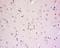 Transgelin 3 antibody, orb158643, Biorbyt, Immunohistochemistry paraffin image 