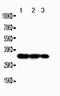 TNF Receptor Associated Factor 3 antibody, PA2008, Boster Biological Technology, Western Blot image 