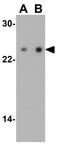 TIR Domain Containing Adaptor Protein antibody, GTX31676, GeneTex, Western Blot image 