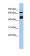 Rho GTPase Activating Protein 1 antibody, orb330774, Biorbyt, Western Blot image 