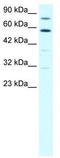 Staphylococcal nuclease domain-containing protein 1 antibody, TA330608, Origene, Western Blot image 