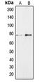 ZFP36 Ring Finger Protein Like 1 antibody, MBS822292, MyBioSource, Western Blot image 