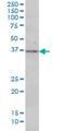 Mitogen-Activated Protein Kinase Kinase 3 antibody, H00005606-M01, Novus Biologicals, Western Blot image 