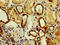 N-Acylsphingosine Amidohydrolase 2 antibody, orb21280, Biorbyt, Immunohistochemistry paraffin image 