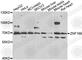 Zinc Finger Protein 169 antibody, A7486, ABclonal Technology, Western Blot image 