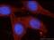 Catenin Beta 1 antibody, 51067-2-AP, Proteintech Group, Immunofluorescence image 