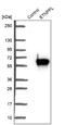 Ethanolamine-Phosphate Phospho-Lyase antibody, NBP1-91655, Novus Biologicals, Western Blot image 