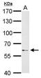P21 (RAC1) Activated Kinase 1 antibody, GTX111208, GeneTex, Western Blot image 