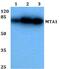 Metastasis-associated protein MTA1 antibody, A01214, Boster Biological Technology, Western Blot image 