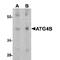 Autophagy Related 4B Cysteine Peptidase antibody, TA349132, Origene, Western Blot image 
