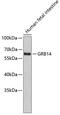 Growth Factor Receptor Bound Protein 14 antibody, 18-798, ProSci, Western Blot image 
