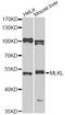 Mixed Lineage Kinase Domain Like Pseudokinase antibody, A13451, ABclonal Technology, Western Blot image 