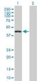 Zinc Finger Protein 302 antibody, H00055900-B01P, Novus Biologicals, Western Blot image 