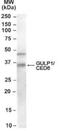 GULP PTB Domain Containing Engulfment Adaptor 1 antibody, NB100-1042, Novus Biologicals, Western Blot image 