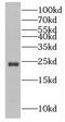 RAB43, Member RAS Oncogene Family antibody, FNab07036, FineTest, Western Blot image 