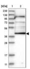 Kynurenine/alpha-aminoadipate aminotransferase, mitochondrial antibody, NBP1-89627, Novus Biologicals, Western Blot image 