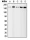 Phospholipase C Gamma 2 antibody, LS-C352676, Lifespan Biosciences, Western Blot image 