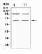 Protein Kinase AMP-Activated Catalytic Subunit Alpha 1 antibody, A00994-3, Boster Biological Technology, Western Blot image 