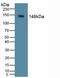 Phosphatidylinositol-4,5-Bisphosphate 3-Kinase Catalytic Subunit Delta antibody, abx131411, Abbexa, Western Blot image 