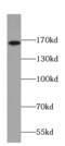 Calmodulin Regulated Spectrin Associated Protein Family Member 2 antibody, FNab01242, FineTest, Western Blot image 