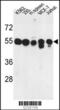 Protein Phosphatase, Mg2+/Mn2+ Dependent 1H antibody, 63-778, ProSci, Western Blot image 
