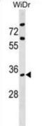 Actin Related Protein 2/3 Complex Subunit 2 antibody, abx030700, Abbexa, Western Blot image 