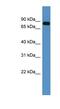 Collagen Type IX Alpha 3 Chain antibody, NBP1-68937, Novus Biologicals, Western Blot image 