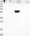 Tetratricopeptide repeat protein 37 antibody, NBP1-93640, Novus Biologicals, Western Blot image 